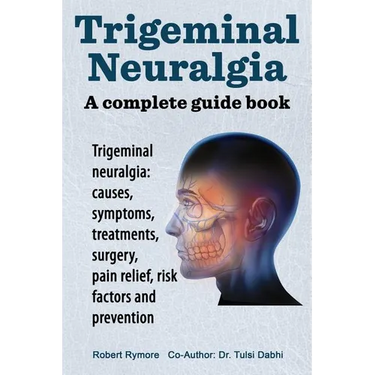 Trigeminal neuralgia: a complete guide book. Trigeminal neuralgia: causes, symptoms, treatments, surgery,
