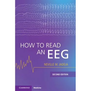 How to Read an Eeg