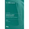 Systemic Lupus Erythematosus: Pathogenesis, Diagnosis and Treatment