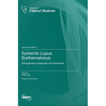 Systemic Lupus Erythematosus: Pathogenesis, Diagnosis and Treatment