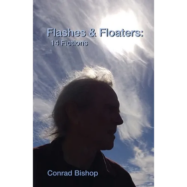 Flashes & Floaters