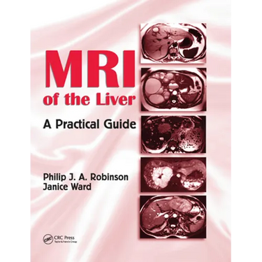 MRI of the Liver: A Practical Guide