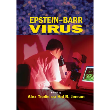 Epstein-Barr Virus