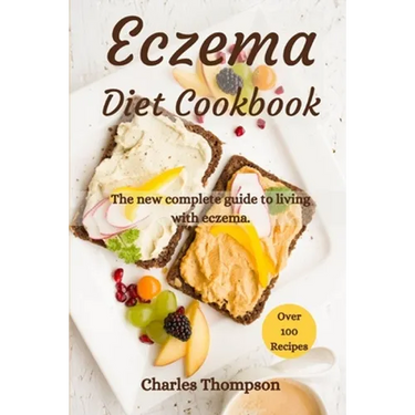 Eczema Diet Cookbook: The new complete guide to living with eczema. More than 100 recipes against the symptoms of dermatitis and psoriasis.
