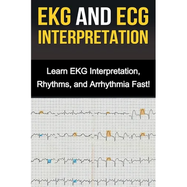 EKG and ECG Interpretation: Learn EKG Interpretation, Rhythms, and Arrhythmia Fast!