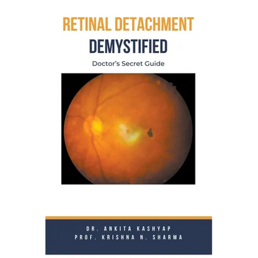 Retinal Detachment Demystified: Doctor's Secret Guide
