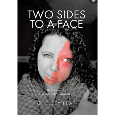 Two Sides to a Face: My Journey with Sturge Weber Syndrome