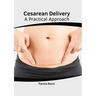 Cesarean Delivery: A Practical Approach