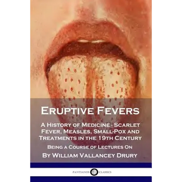 Eruptive Fevers: A History of Medicine - Scarlet Fever, Measles, Small-Pox and Treatments in the 19th Century - Being a Course of Lectures On