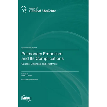 Pulmonary Embolism and Its Complications: Causes, Diagnosis and Treatment