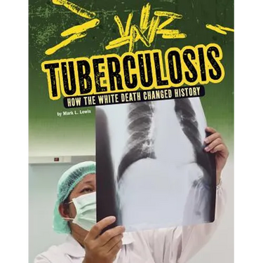 Tuberculosis: How the White Death Changed History
