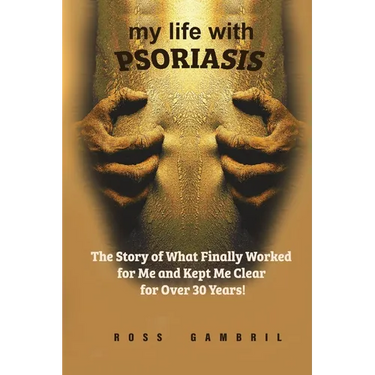 my life with PSORIASIS: The story of what finally worked for me and kept me clear for over 30 years!
