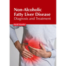 Non-Alcoholic Fatty Liver Disease: Diagnosis and Treatment
