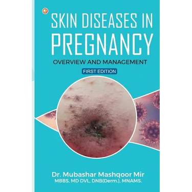 Skin Diseases in Pregnancy: Overview and Management