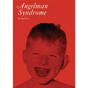 Angelman Syndrome