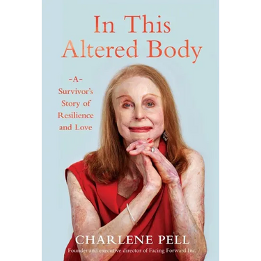 In This Altered Body: A Survivor's Story of Resilience and Love