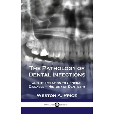 Pathology of Dental Infections: and Its Relation to General Diseases - History of Dentistry