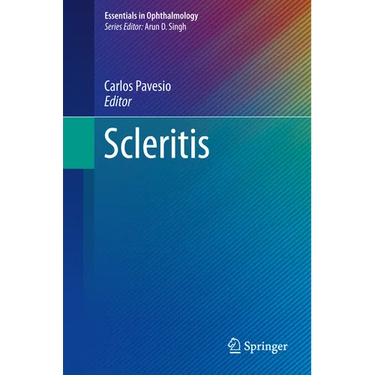 Scleritis