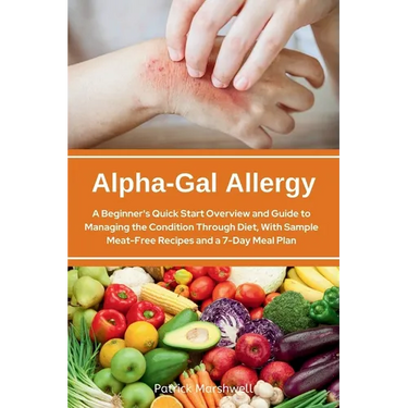 Alpha-Gal Allergy: A Beginner's Quick Start Overview and Guide to Managing the Condition Through Diet, with Sample Meat-Free Recipes and