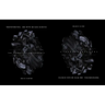 Transtraterrestrial: Dark Matter and Black Divinities