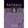 Epilepsy Simplified