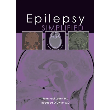 Epilepsy Simplified