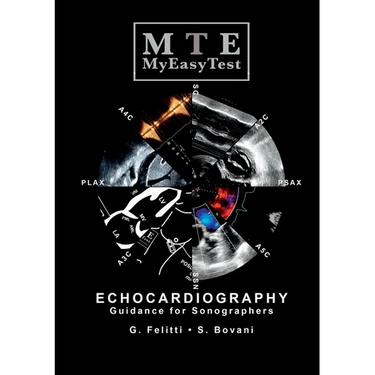 Echocardiography - MyEasyTest