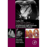 Cardiac MRI in Diagnosis, Clinical Management, and Prognosis of Arrhythmogenic Right Ventricular Cardiomyopathy/Dysplasia