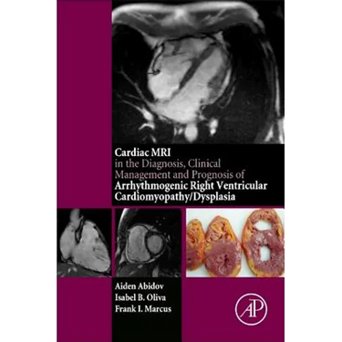 Cardiac MRI in Diagnosis, Clinical Management, and Prognosis of Arrhythmogenic Right Ventricular Cardiomyopathy/Dysplasia