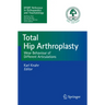 Total Hip Arthroplasty: Wear Behaviour of Different Articulations