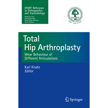 Total Hip Arthroplasty: Wear Behaviour of Different Articulations