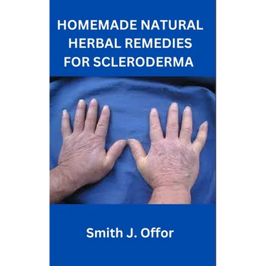 Homemade Natural Herbal Remedies for Scleroderma