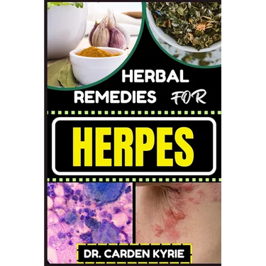 Herbal Remedies for Herpes: Unlocking Nature's Healing Power For Targeting Relief, Holistic Wellness, Immune Support And Integrating Herbs Into Yo