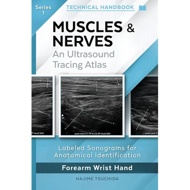 Technical Ultrasound Handbook - Muscles & Nerves: An Ultrasound Tracing Atlas (Series 1)