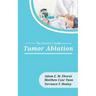 Tumor Ablation