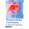 Hepatocellular Carcinoma: Clinical Findings