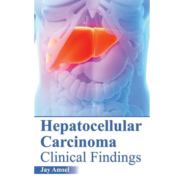 Hepatocellular Carcinoma: Clinical Findings