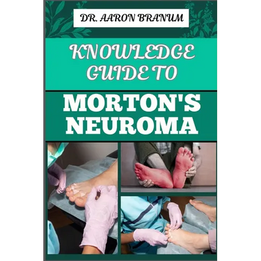 Knowledge Guide to Morton's Neuroma: Essential Manual To Symptoms, Diagnosis, Treatment, And Pain Relief For Foot Health And Nerve Pain Management