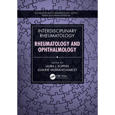 Interdisciplinary Rheumatology: Rheumatology and Ophthalmology