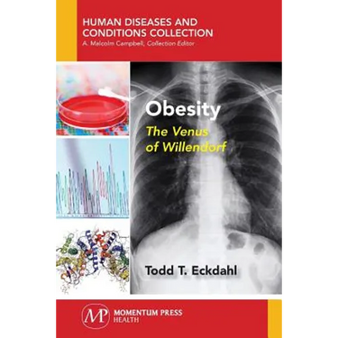 Obesity: The Venus of Willendorf