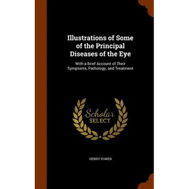 Illustrations of Some of the Principal Diseases of the Eye: With a Brief Account of Their Symptoms, Pathology, and Treatment