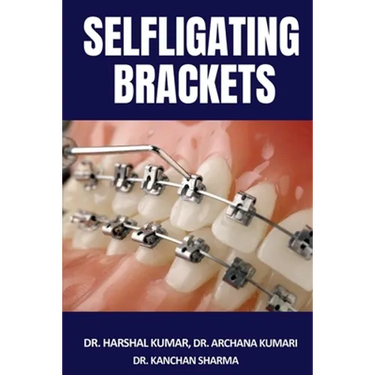 Selfligating Brackets