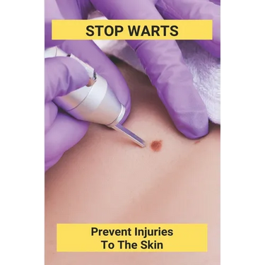 Stop Warts: Prevent Injuries To The Skin: Warts Treatment Near Me