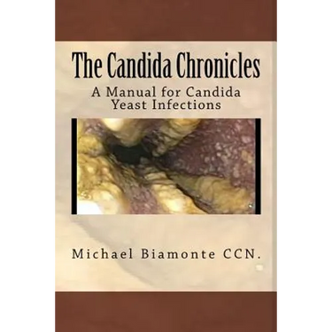 The Candida Chronicles: A Mannual for Candida/Yeast Infections
