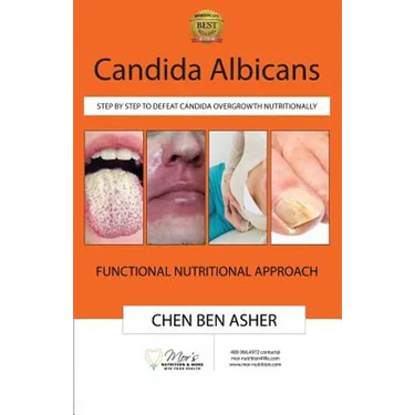 Candida Albicans: Step by Step to Defeat Candida Overgrowth Nutritionally