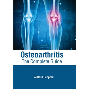 Osteoarthritis: The Complete Guide