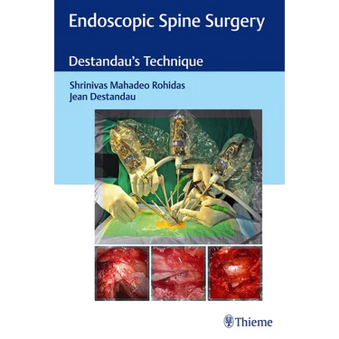 Endoscopic Spine Surgery: Destandau's Technique