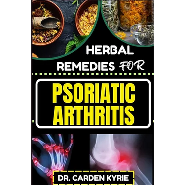 Herbal Remedies for Psoriatic Arthritis: Empower Your Journey To Wellness With Herbs For Alleviating Pain, Restoring Joint Health And Nurturing Overal