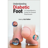 Understanding Diabetic Foot