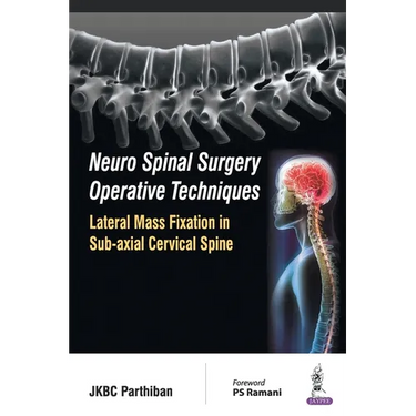 Neuro Spinal Surgery Operative Techniques Lateral Mass Fixation in Sub-axial Cervical Spine